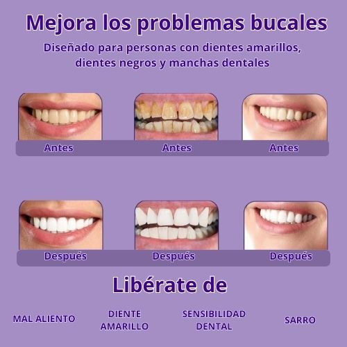 Blanqueador Dental Lila V34 Dientes en Solo 3 Días