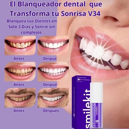 Blanqueador Dental Lila V34 Dientes en Solo 3 Días