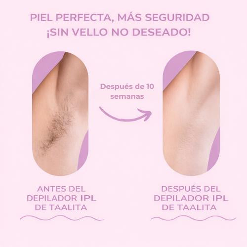 Depilación en casa. Sin dolor. Sin citas.