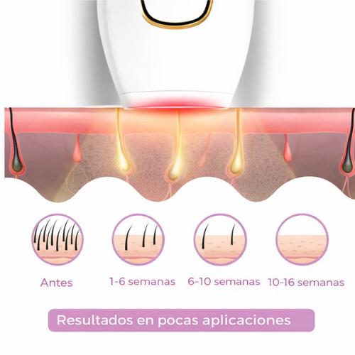 Depilación en casa. Sin dolor. Sin citas.